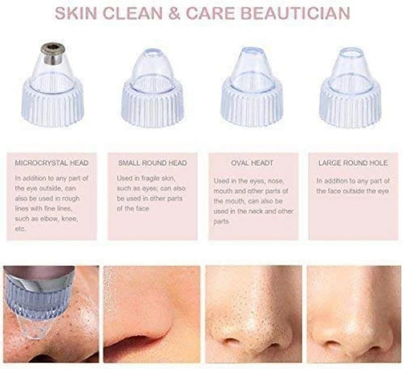 5-Level Pore Vacuum Blackhead Remover – جهاز شفط المسام وإزالة الرؤوس السوداء