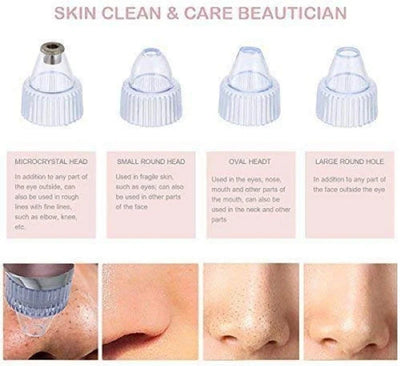 5-Level Pore Vacuum Blackhead Remover – جهاز شفط المسام وإزالة الرؤوس السوداء